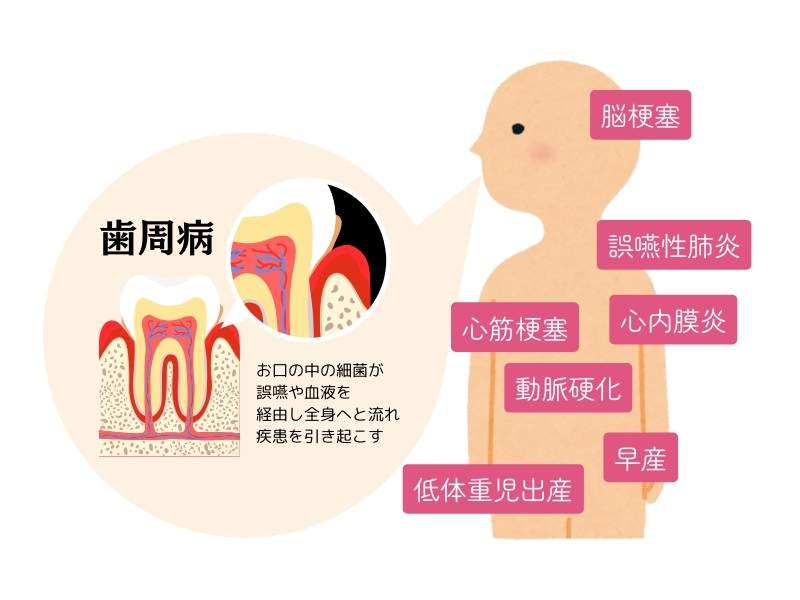 名称未設定